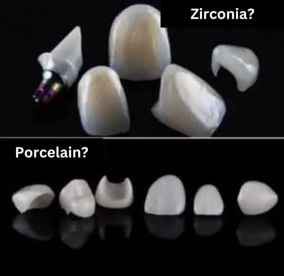 Zirconia and porcelain crowns and veneers shown against a black background